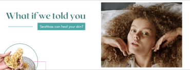 A banner stating "What if we told you Sea Moss can heal your skin?"