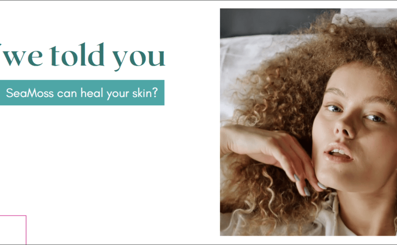 A banner stating "What if we told you Sea Moss can heal your skin?"